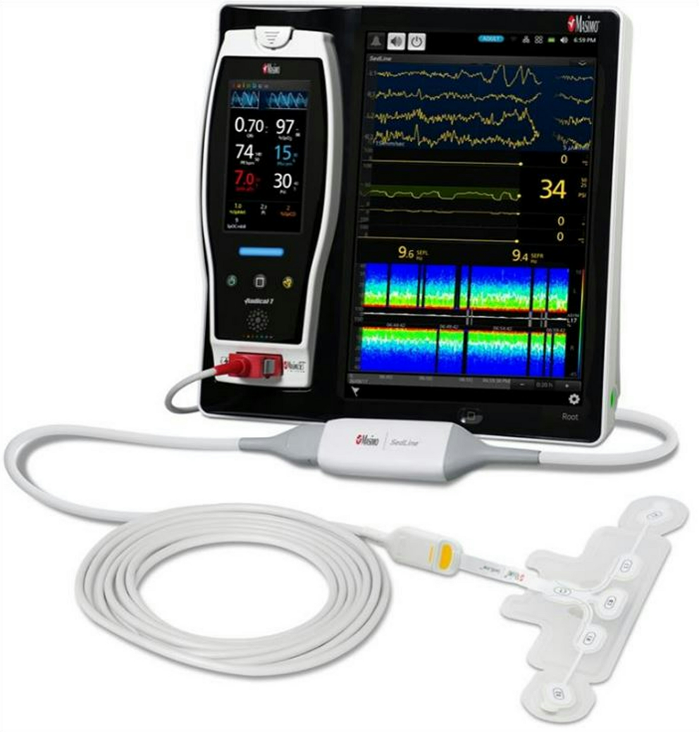 Assessment of recovery in maxillofacial surgical patients undergoing intravenous conscious sedation using PSI monitoring