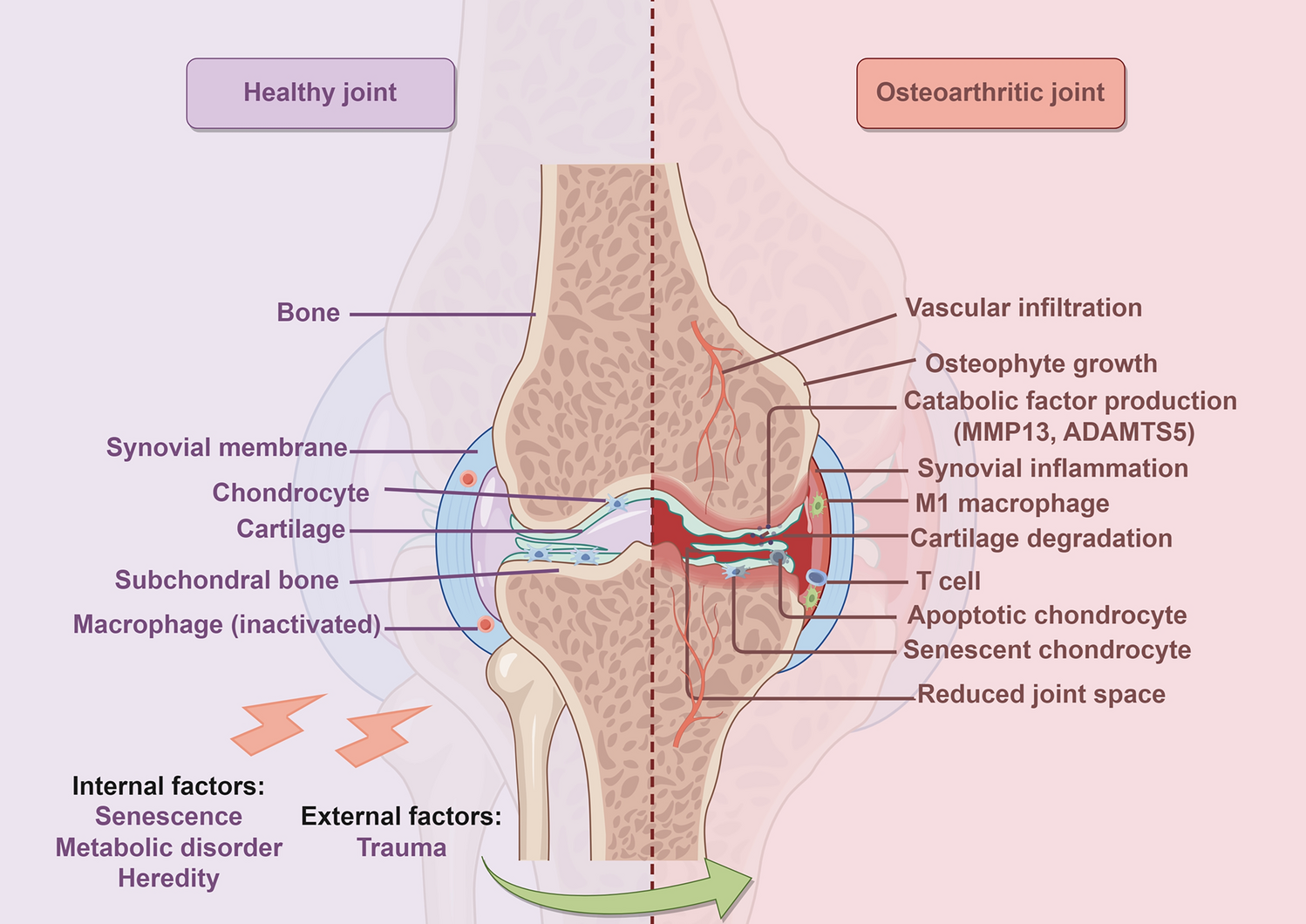 Emerging Therapy in Osteoarthritis: Mesenchymal Stem Cells, Secretomes, and Using Hydrogels to Enhance Efficacy