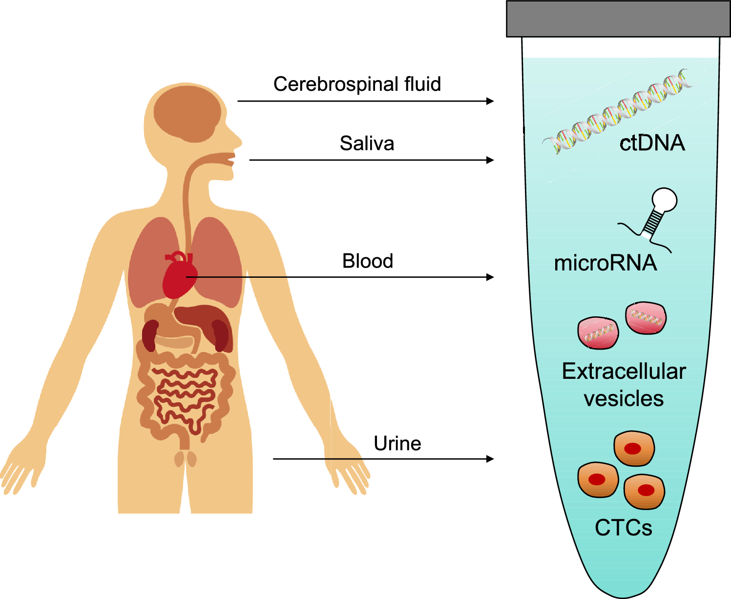 Advances in liquid biopsy for bone and soft-tissue sarcomas