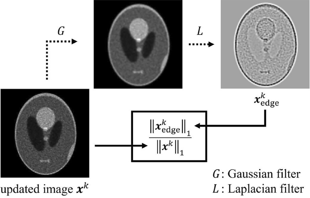 Hyperparameter-controlled regularized reconstruction method based on object structure and acquisition conditions in SPECT