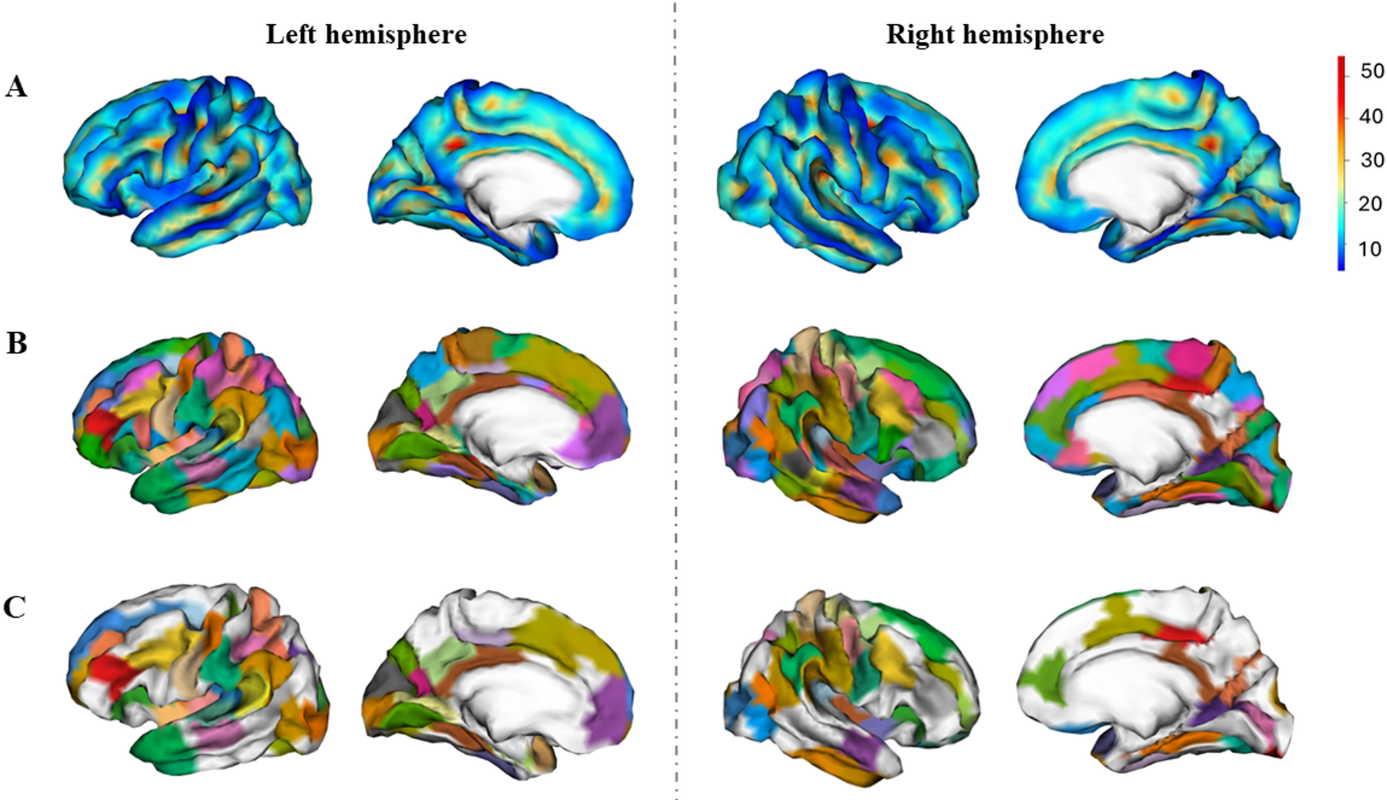 Sulcal pits as potential markers of early sex-related human brain differences in healthy adults
