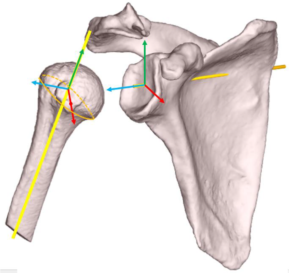 Total shoulder arthroplasty preoperative planning: the effect of patient’s humeral position on the lateralization and distalization measurements