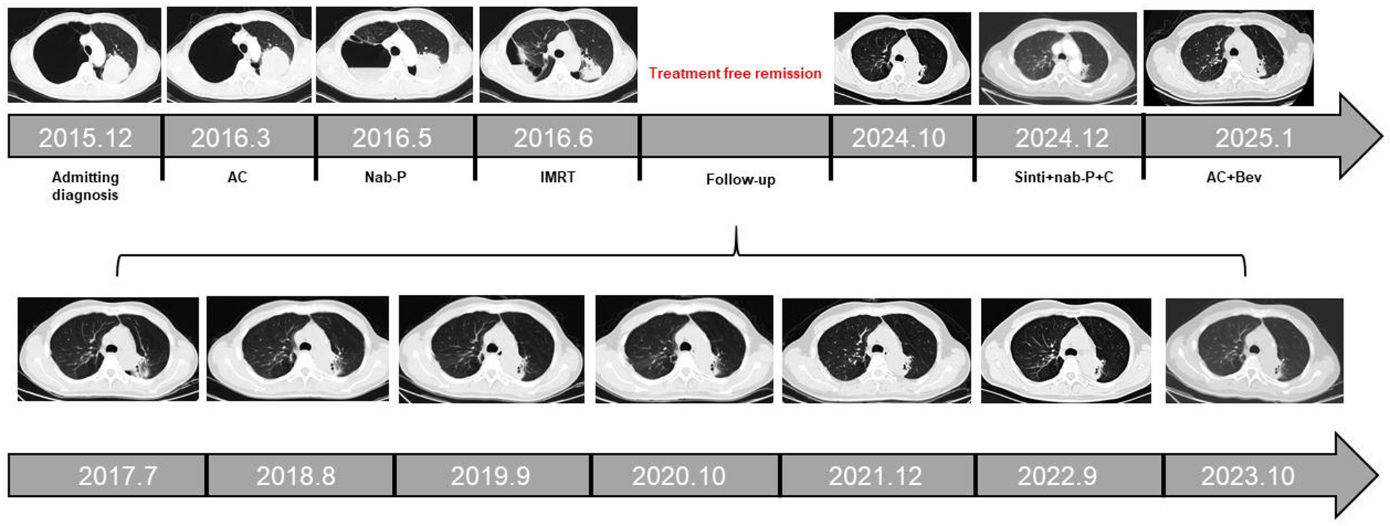A Rare Case of Long-Term Survival in Stage IIIB Lung Adenocarcinoma: an 9-Year Follow-Up