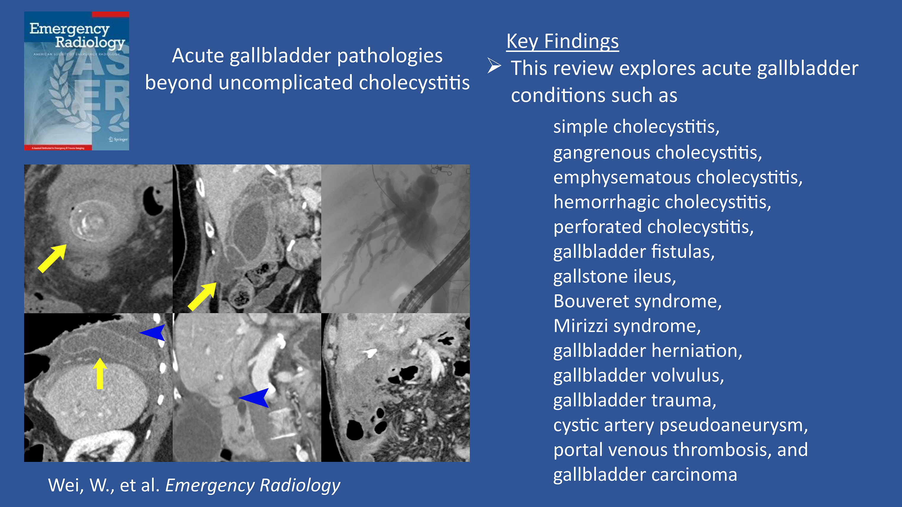 Acute gallbladder pathologies beyond uncomplicated cholecystitis