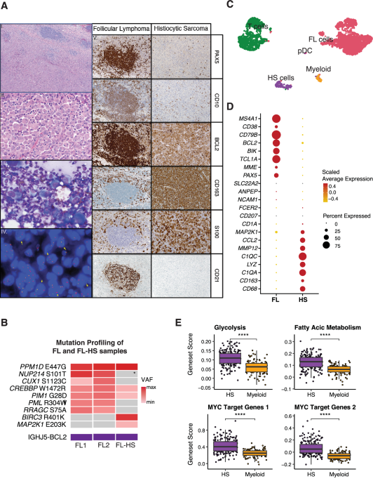 Co-occurrence of clonally related follicular lymphoma and histiocytic sarcoma