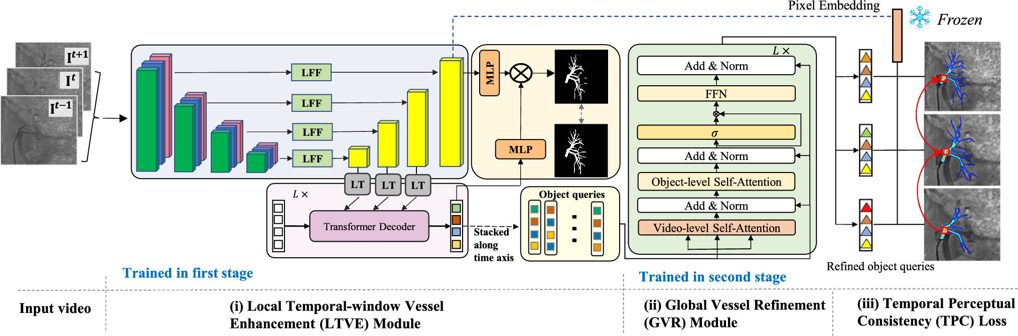 Temporal consistency-aware network for renal artery segmentation in X-ray angiography