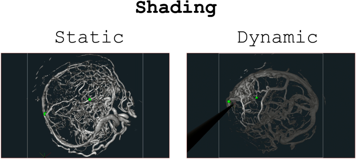 Assessment of cognitive load in the context of neurosurgery
