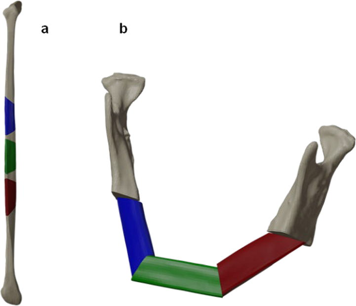 Comparison of the accuracy of different slot properties of 3D-printed cutting guides for raising free fibular flaps using saw or piezoelectric instruments: an in vitro study
