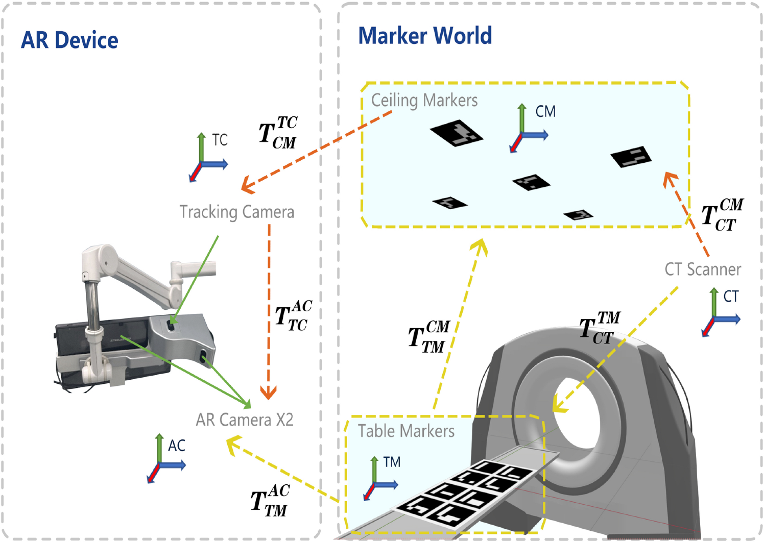 Efficient needle guidance: multi-camera augmented reality navigation without patient-specific calibration
