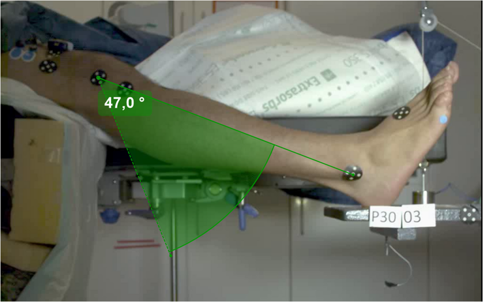 Validation of computational models simulating injury-related kinematics with muscle activation – obtaining data under general anaesthesia