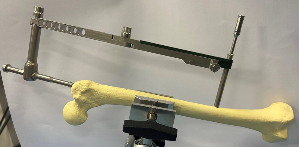 Frugal Innovations in Orthopaedics