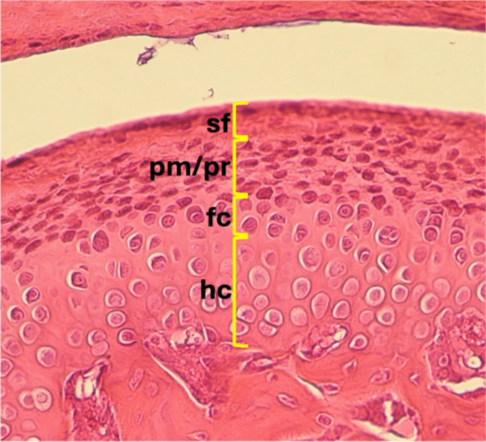 Protective effects of ozone therapy on cartilage degeneration in temporomandibular joint osteoarthritis