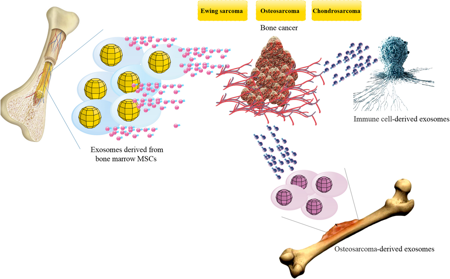 The therapeutic potential of exosomes in bone cancers: osteosarcoma, chondrosarcoma, and Ewing sarcoma