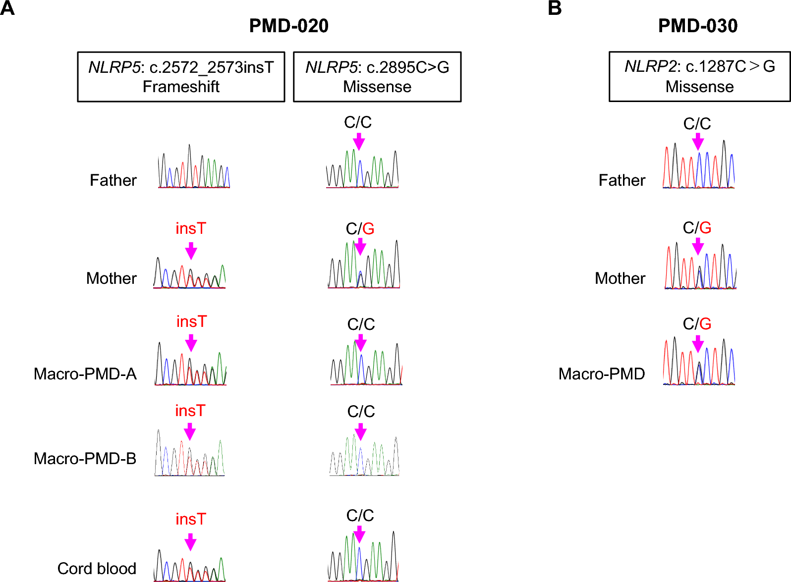 Variants of NLRP genes encoding subcortical maternal complex components are linked to biparental placental mesenchymal dysplasia