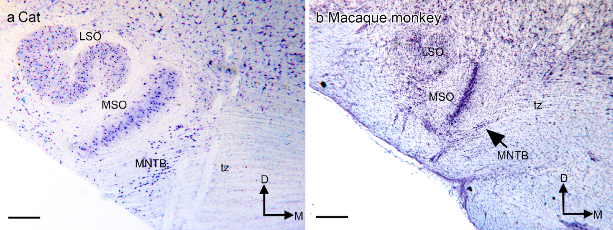 Individual variability in the nuclei of the human superior olivary complex
