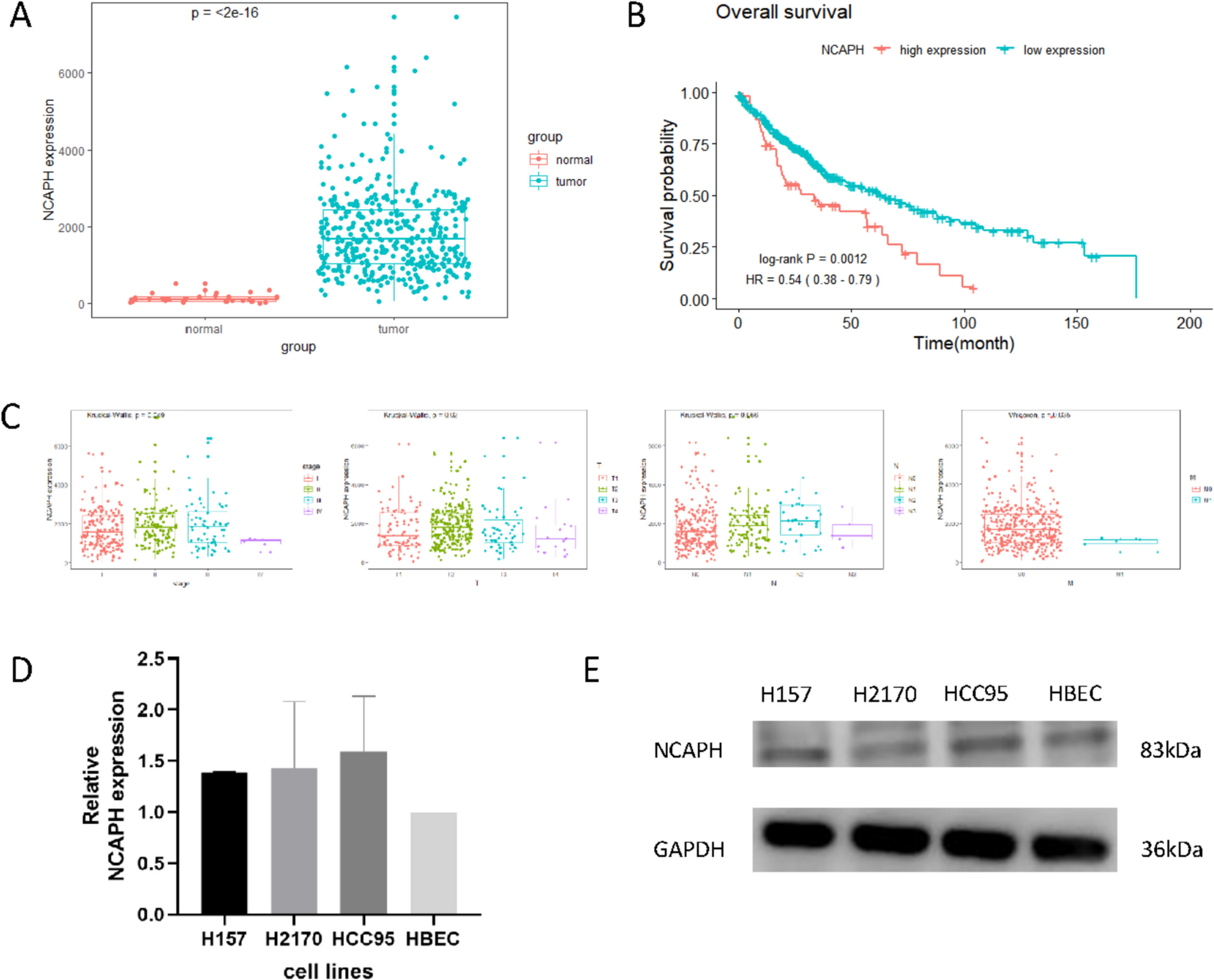 MiR-1976 affects lung squamous cell carcinoma development by targeting NCAPH