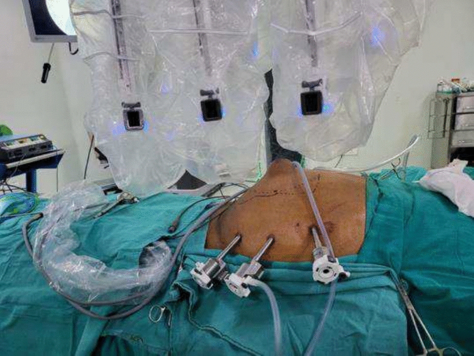 Robotic Ventral Hernia Repair—Current Status