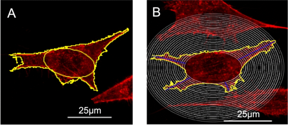 Impacts of Nonenzymatic Glycation Crosslinks in Bone Matrix on the Mechanosensitivity of Osteocyte