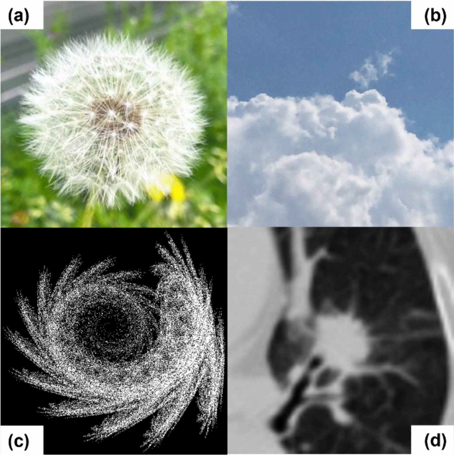 Fractal-driven self-supervised learning enhances early-stage lung cancer GTV segmentation: a novel transfer learning framework