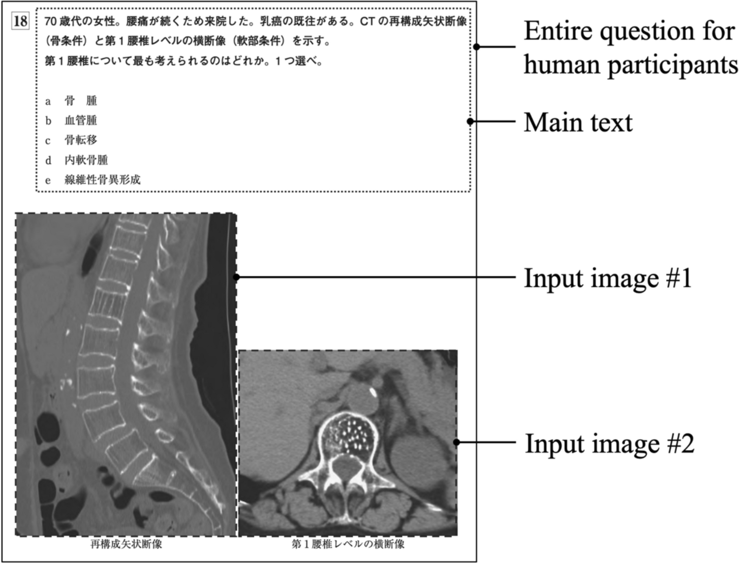 Assessing accuracy and legitimacy of multimodal large language models on Japan Diagnostic Radiology Board Examination