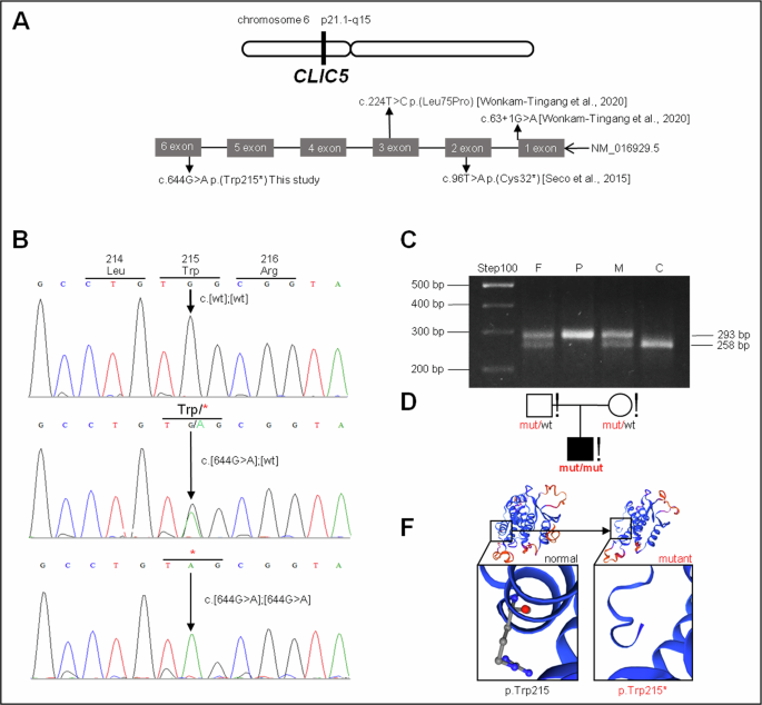 The c.644 G > A p.(Trp215*) founder variant in the CLIC5 gene causes progressive autosomal recessive deafness 103 (DFNB103) in Eastern Siberia