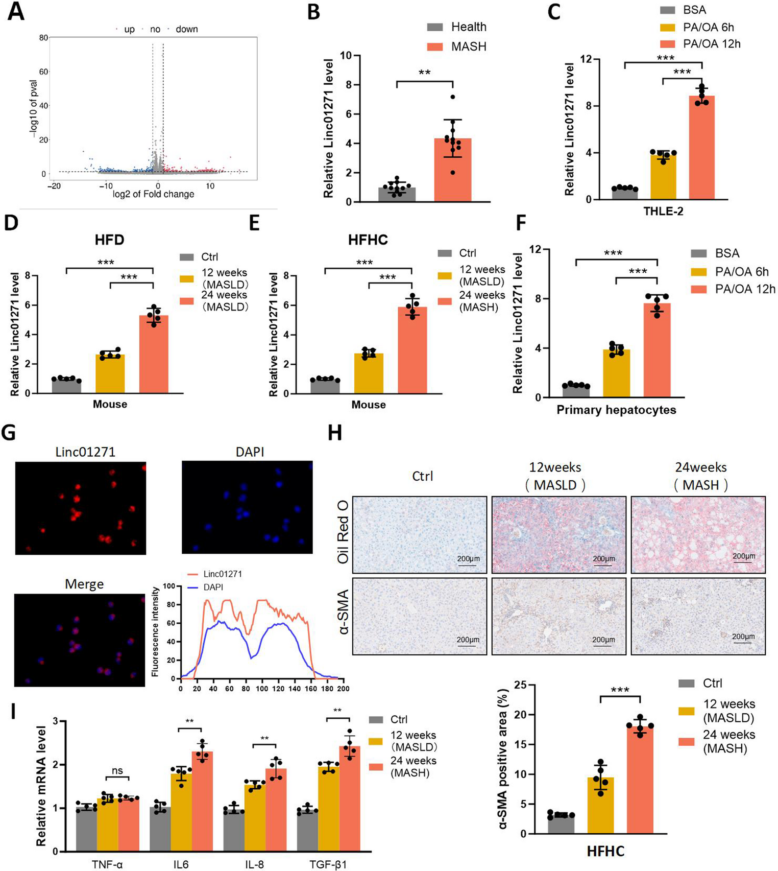 Linc01271 promotes lipid synthesis and MASLD/MASH progression via miR-149-3p/RAB35 axis