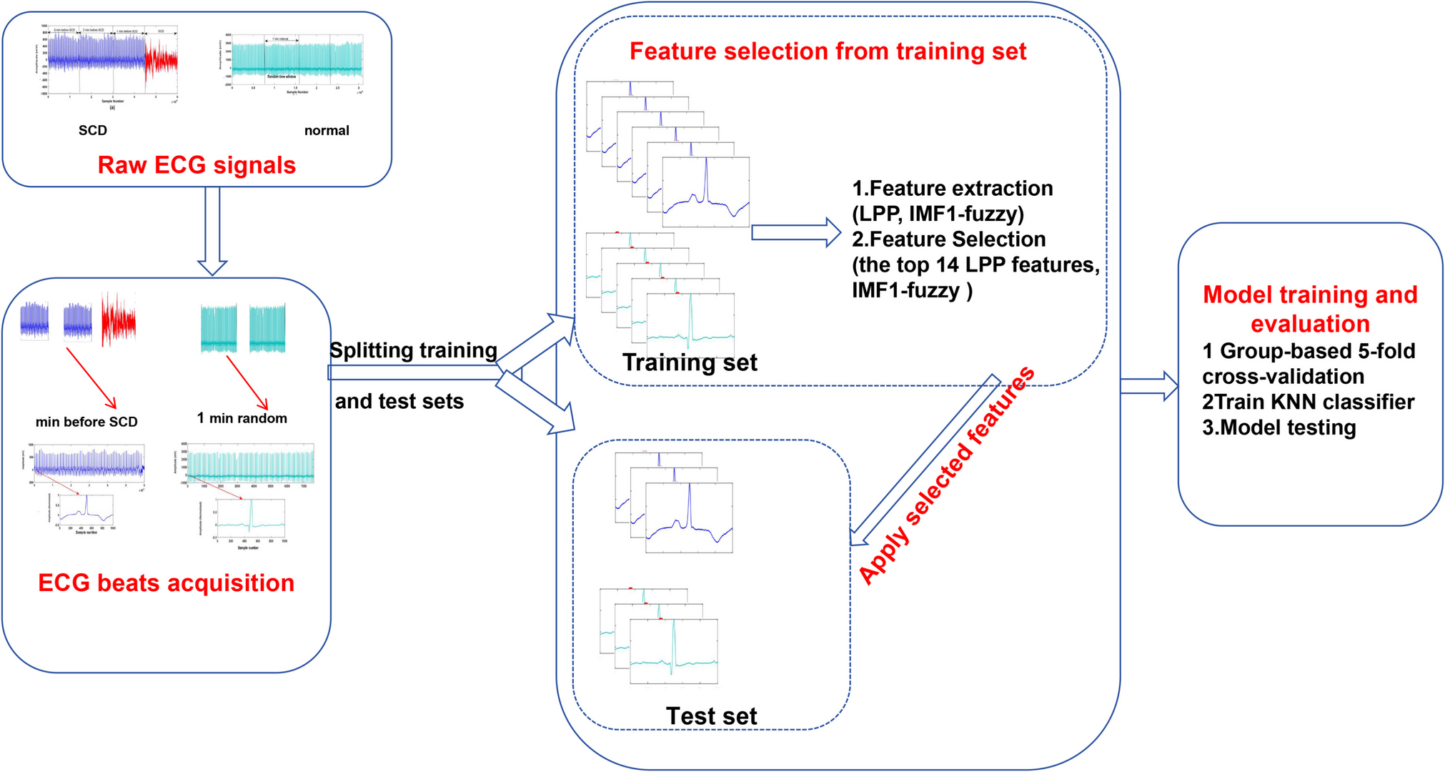 Automated Characterization of Sudden Cardiac Death Using Locality Preserving Projection and Fuzzy Entropy Based on Empirical Mode Decomposition from ECG Signals