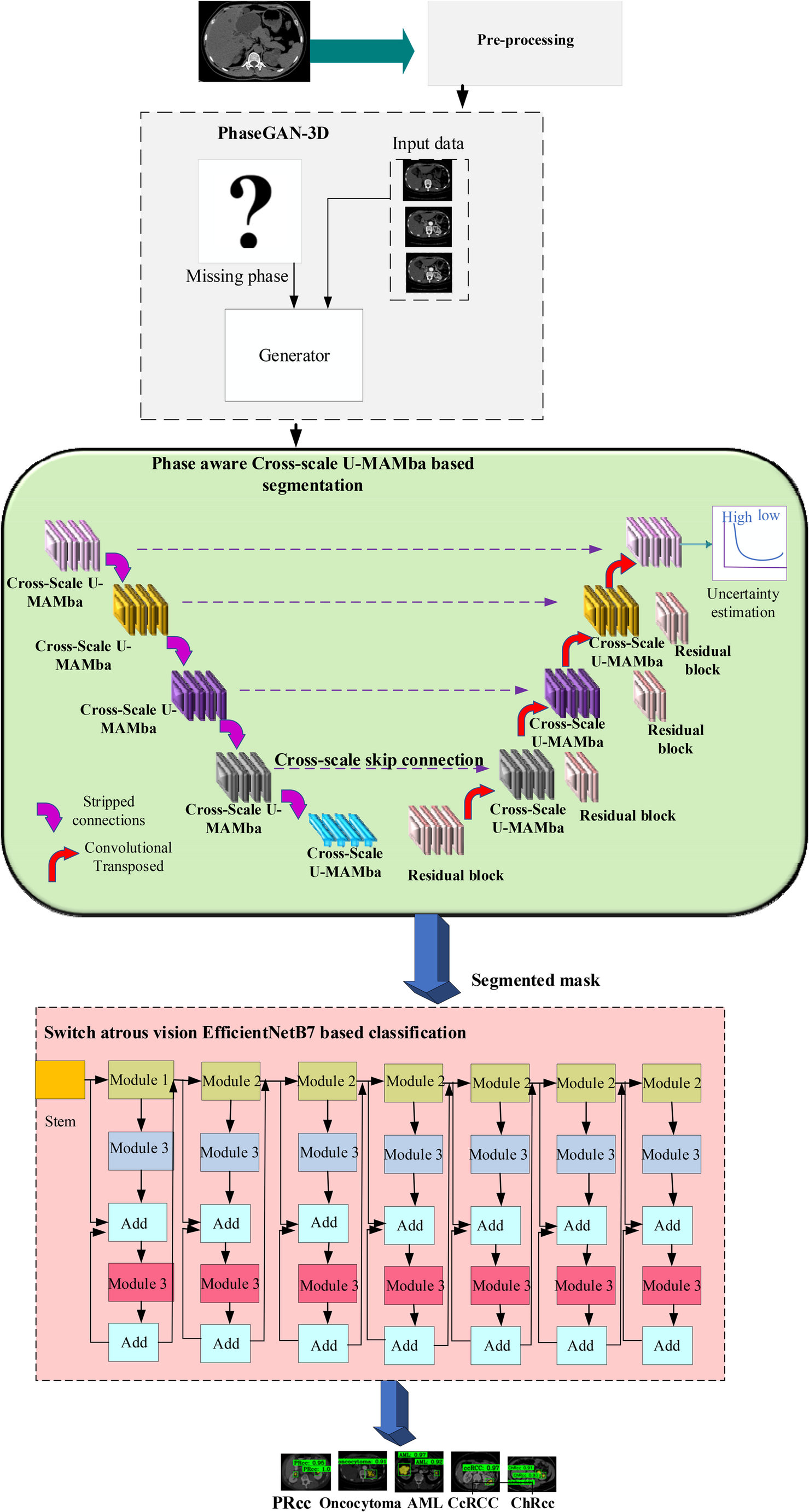 A phase-aware Cross-Scale U-MAMba with uncertainty-aware segmentation and Switch Atrous Bifovea EfficientNetB7 classification of kidney lesion subtype