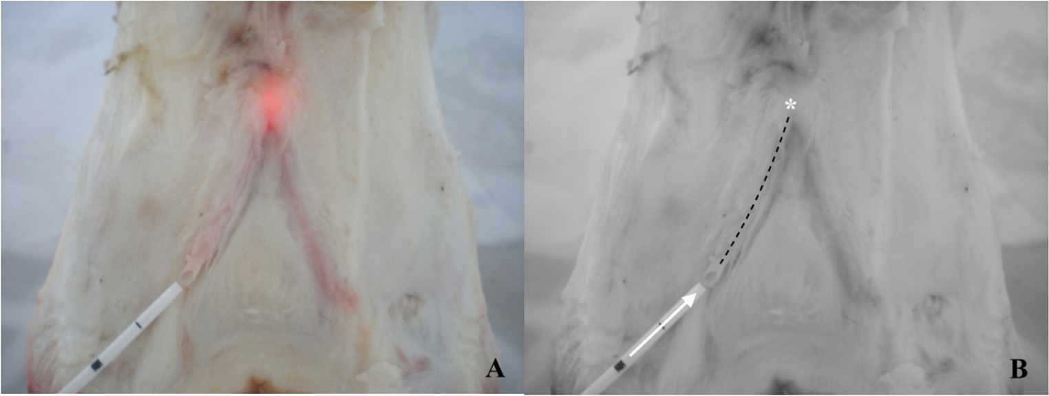 Investigation of the effects of endovenous thermocoagulation methods on perivenous and venous tissue in an ex-vivo animal model