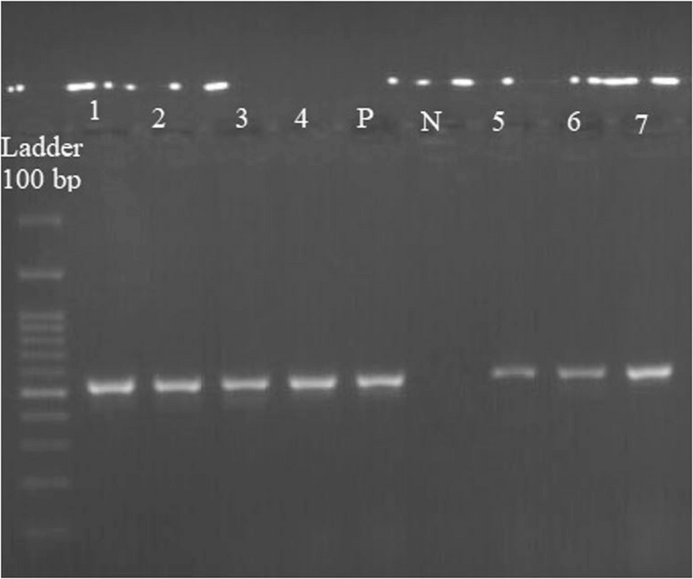 Photodynamic therapy with Rose Bengal against resistant : effects on  efflux gene expression