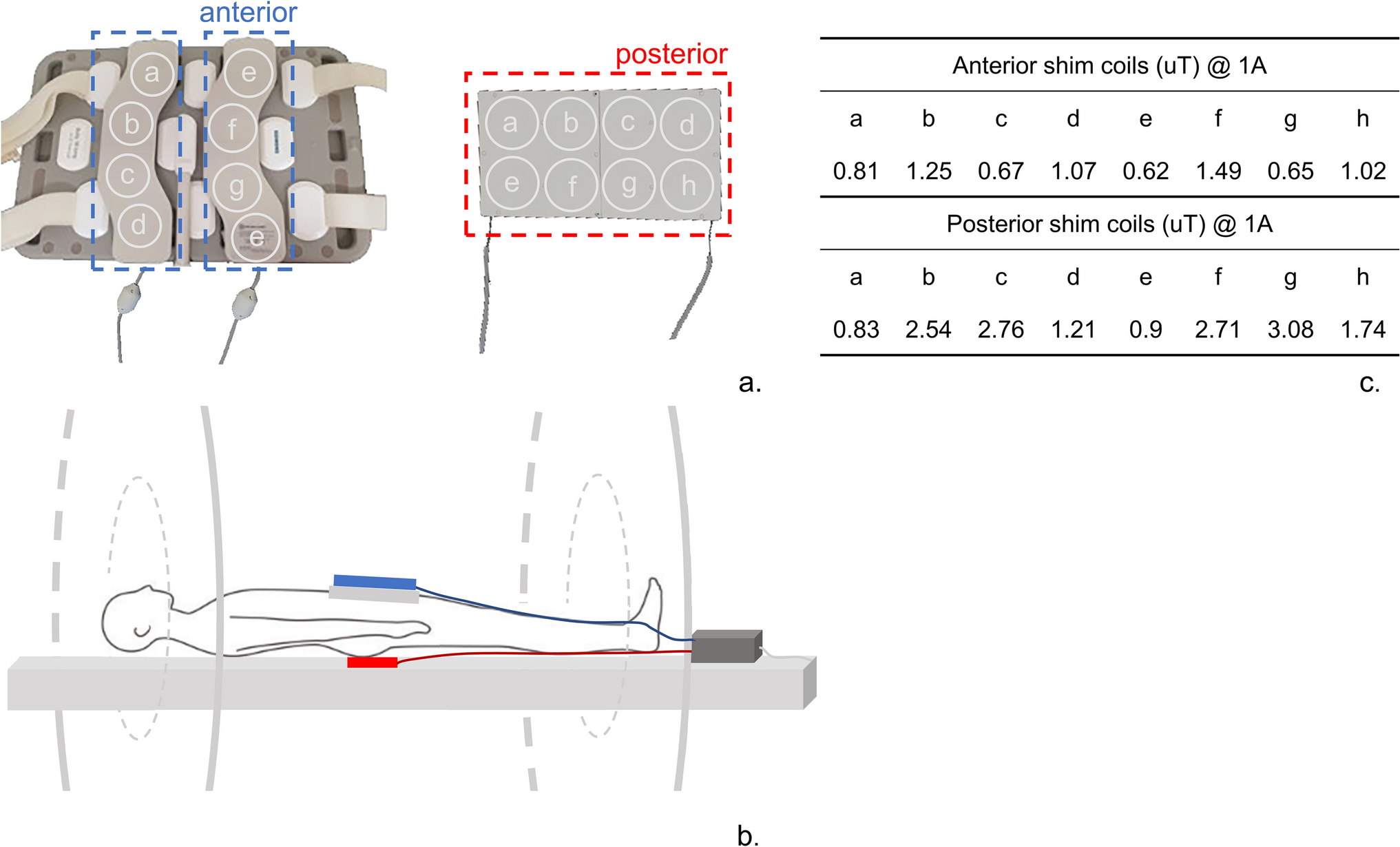 Improving magnetic field homogeneity in prostate MR imaging and spectroscopy using an add-on local external shim coil array