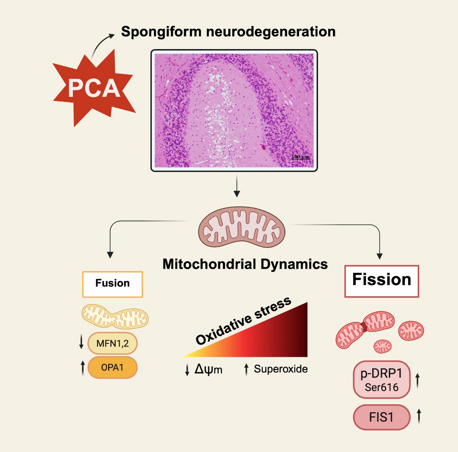 Portacaval anastomosis promotes fragmentation of mitochondrial network in the cerebellum of male rats