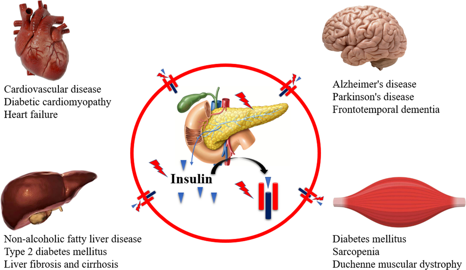 Exercise training enhances myokine release and reduces brain insulin resistance: insights into muscle-CNS metabolic cross-talk