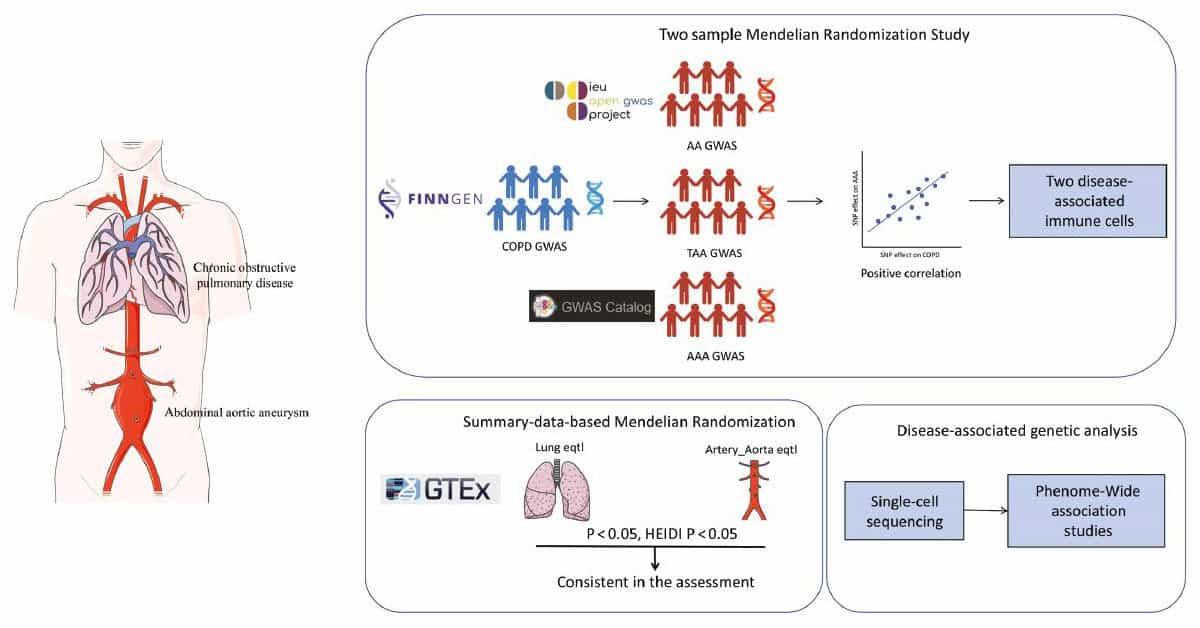 Genetic and Molecular Relationships Between Chronic Obstructive Pulmonary Disease and Abdominal Aortic Aneurysm: Insights from a Multi-Omics Approach