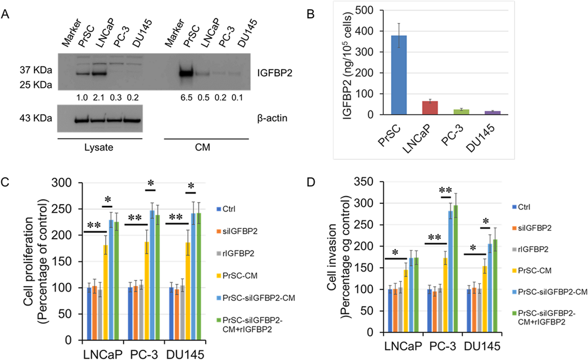 IGFBP2 alteration contributes to prostate cancer progression by modulating prostate stroma activation