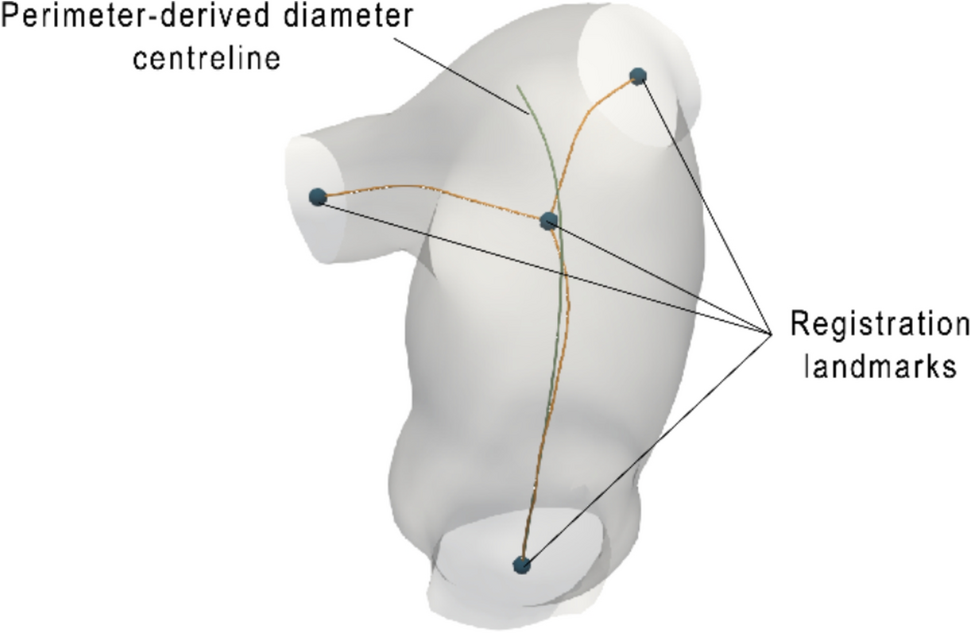 Right Ventricular Outflow Tract and Pulmonary Artery Strains During the Cardiac Cycle Prior to Pulmonary Valve Replacement