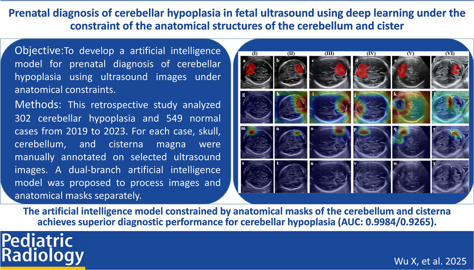 Prenatal diagnosis of cerebellar hypoplasia in fetal ultrasound using deep learning under the constraint of the anatomical structures of the cerebellum and cistern