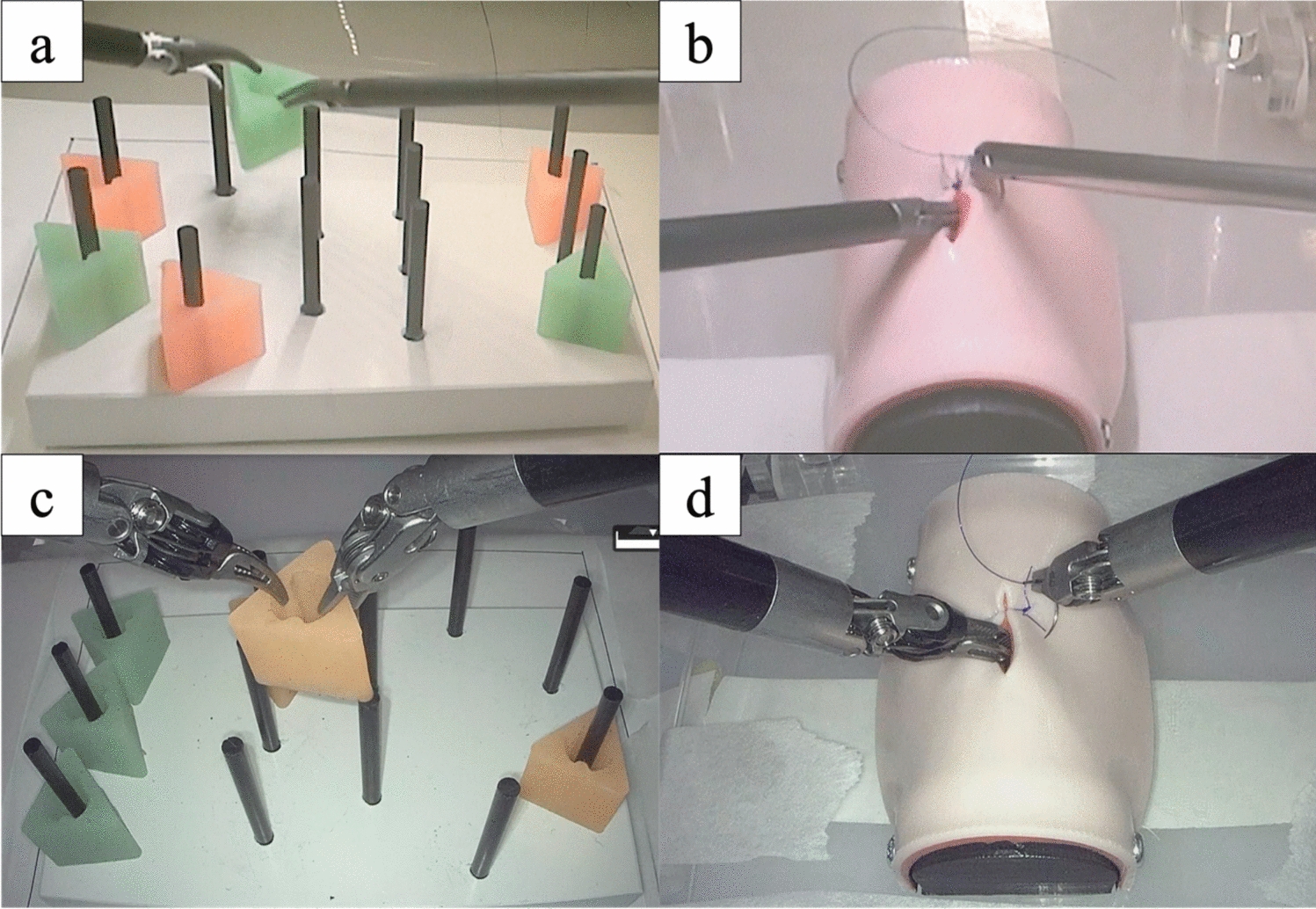 Initial adaptation and surgical performance of the hinotori™ robotic system among pediatric surgeons with minimal robotic exposure