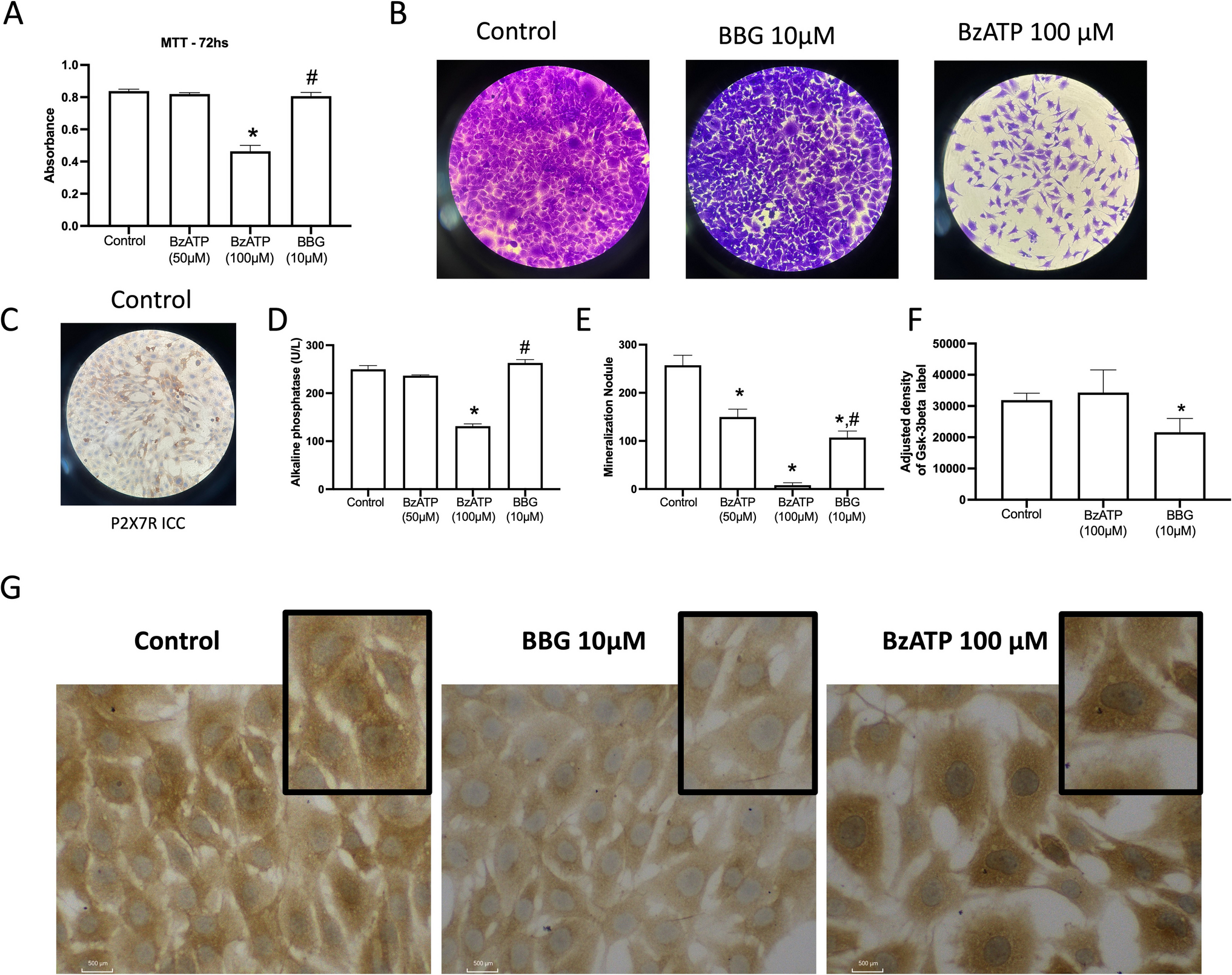 Blockage of P2X7 receptor activation attenuated bone loss in ligature-induced model of periodontitis in rats