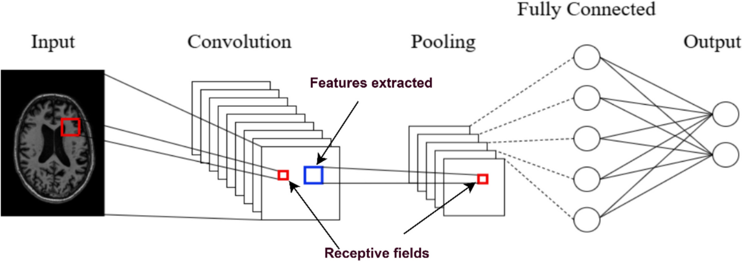 Leveraging deep learning for early diagnosis of Alzheimer’s disease via brain MRI imaging