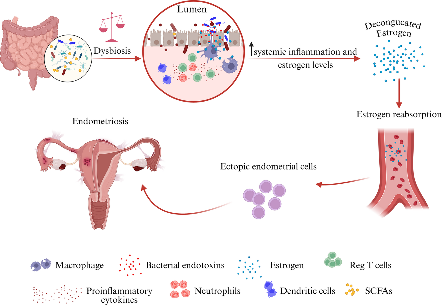 The Role of the Microbiome in Endometriosis