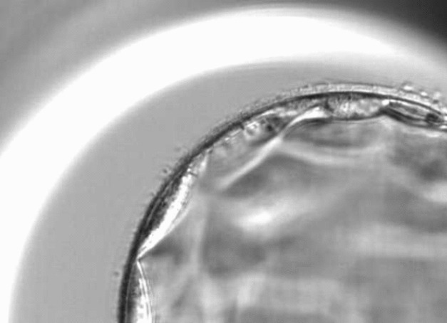 Inner Cell Mass Grade and Earlier Blastulation Are Associated with Pregnancy Outcomes in Euploid Embryos