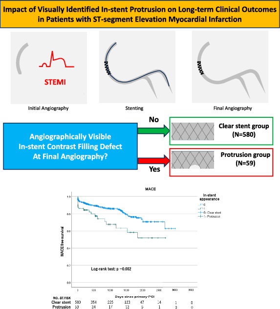 Impact of visually identified in-stent protrusion on long-term clinical outcomes in patients with ST-segment elevation myocardial infarction