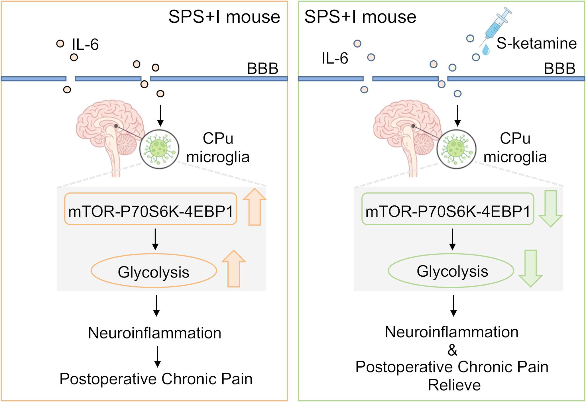 S-Ketamine Alleviates Anxiety-Induced Chronic Postoperative Pain by Affecting Glucose Metabolism of Striatal Microglia in a Rat Model