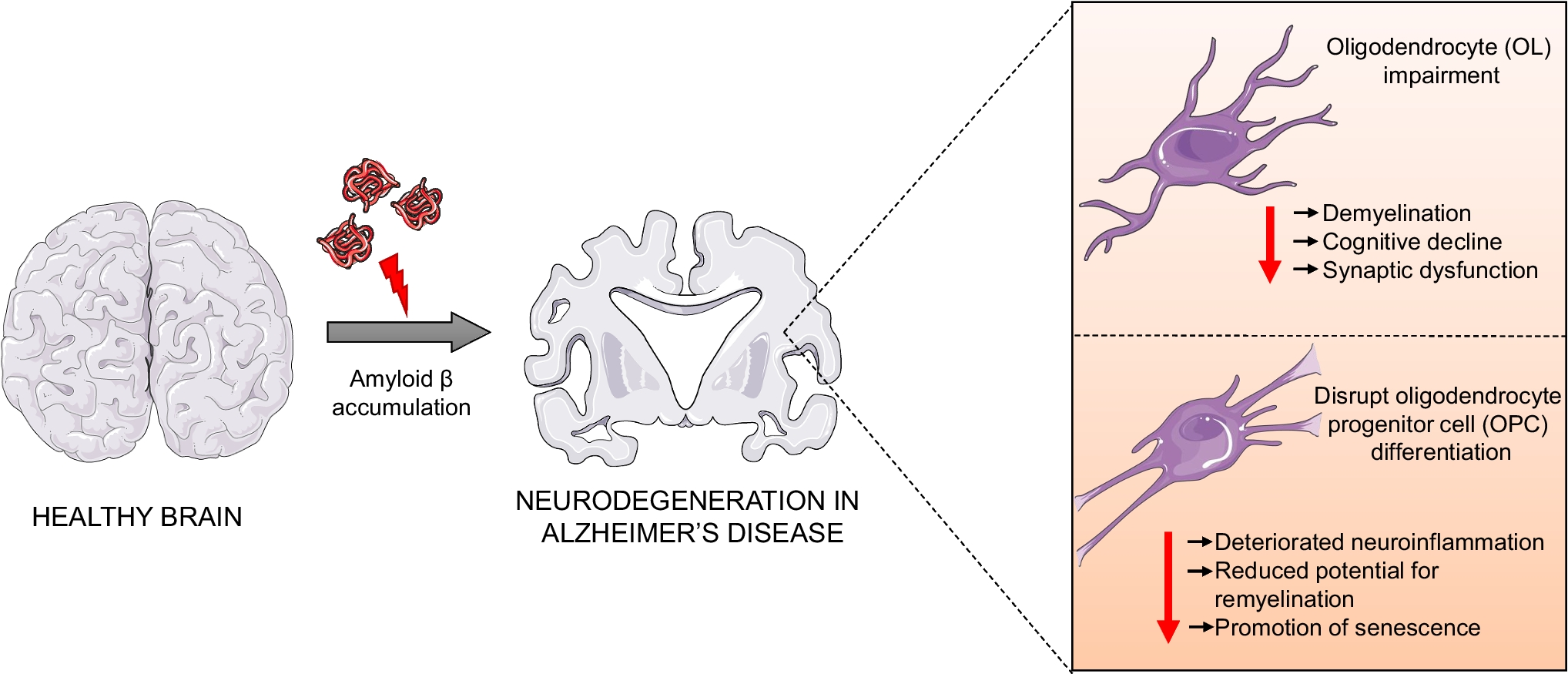 Emerging Role of Oligodendrocytes Malfunction in the Progression of Alzheimer's Disease