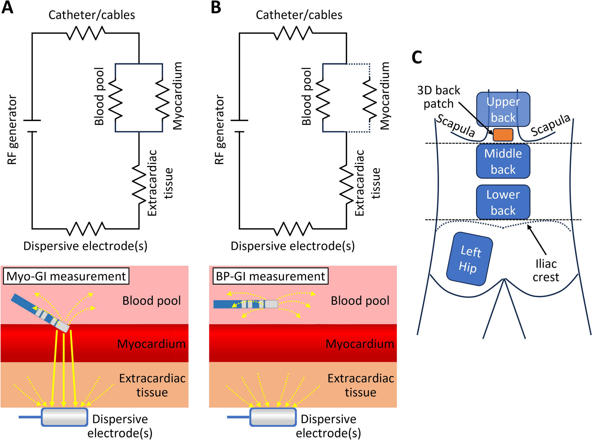 Evaluation of the contributors of generator impedance during radiofrequency catheter ablation