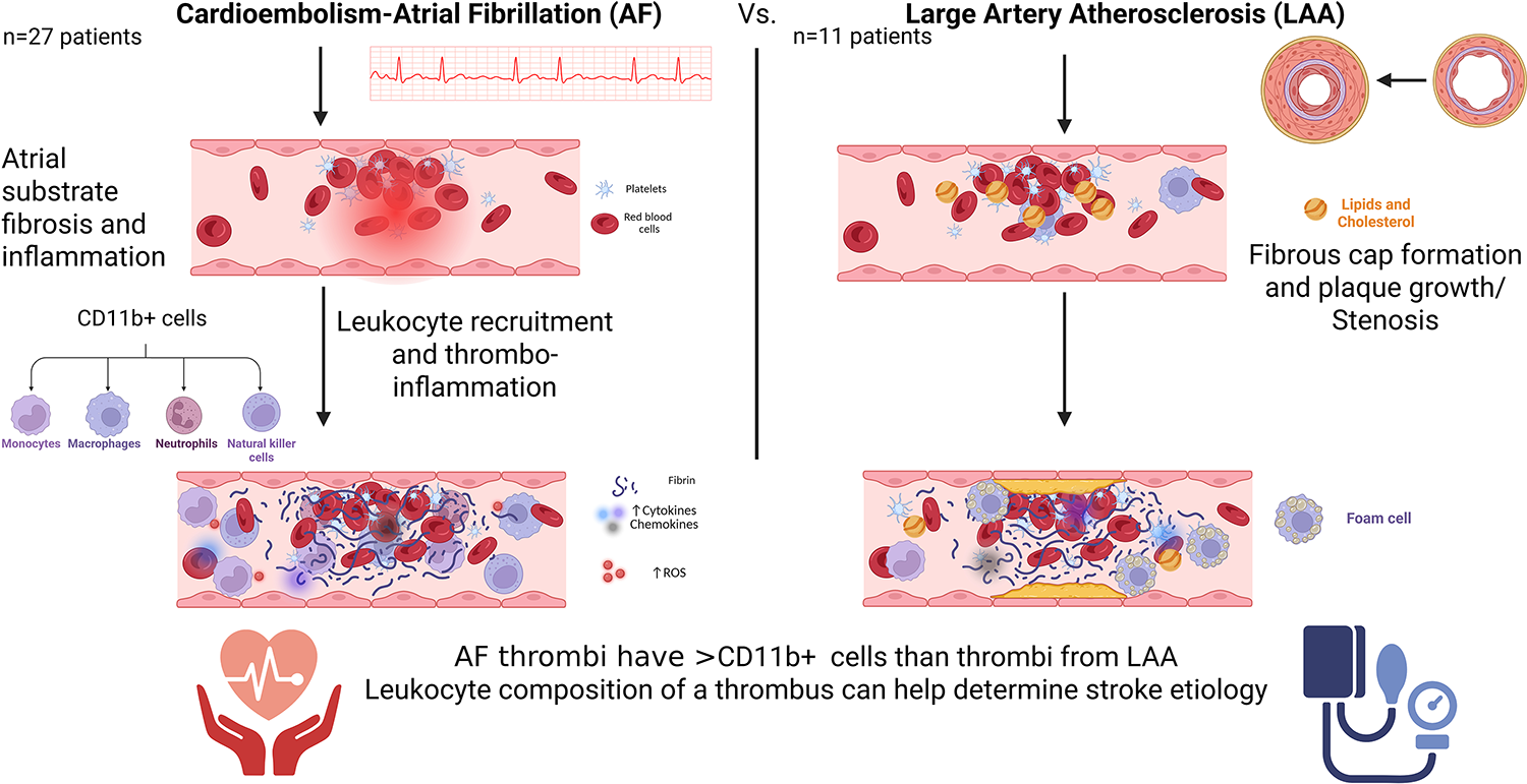 Thrombi from stroke due to cardioembolic etiology have higher CD11b-positive cells compared to large artery atherosclerosis