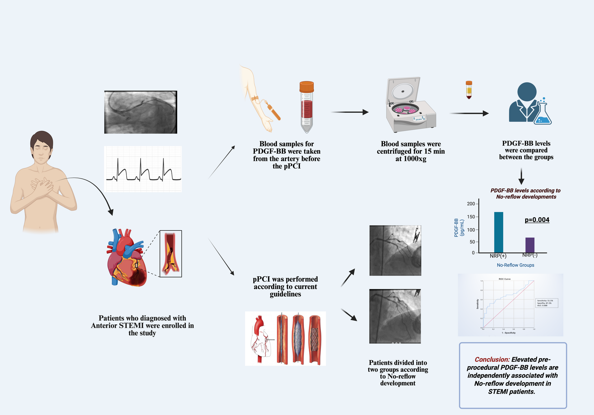Platelet-derived growth factor-BB is A novel inflammatory biomarker of No-Reflow in STEMI patients treated with primary PCI