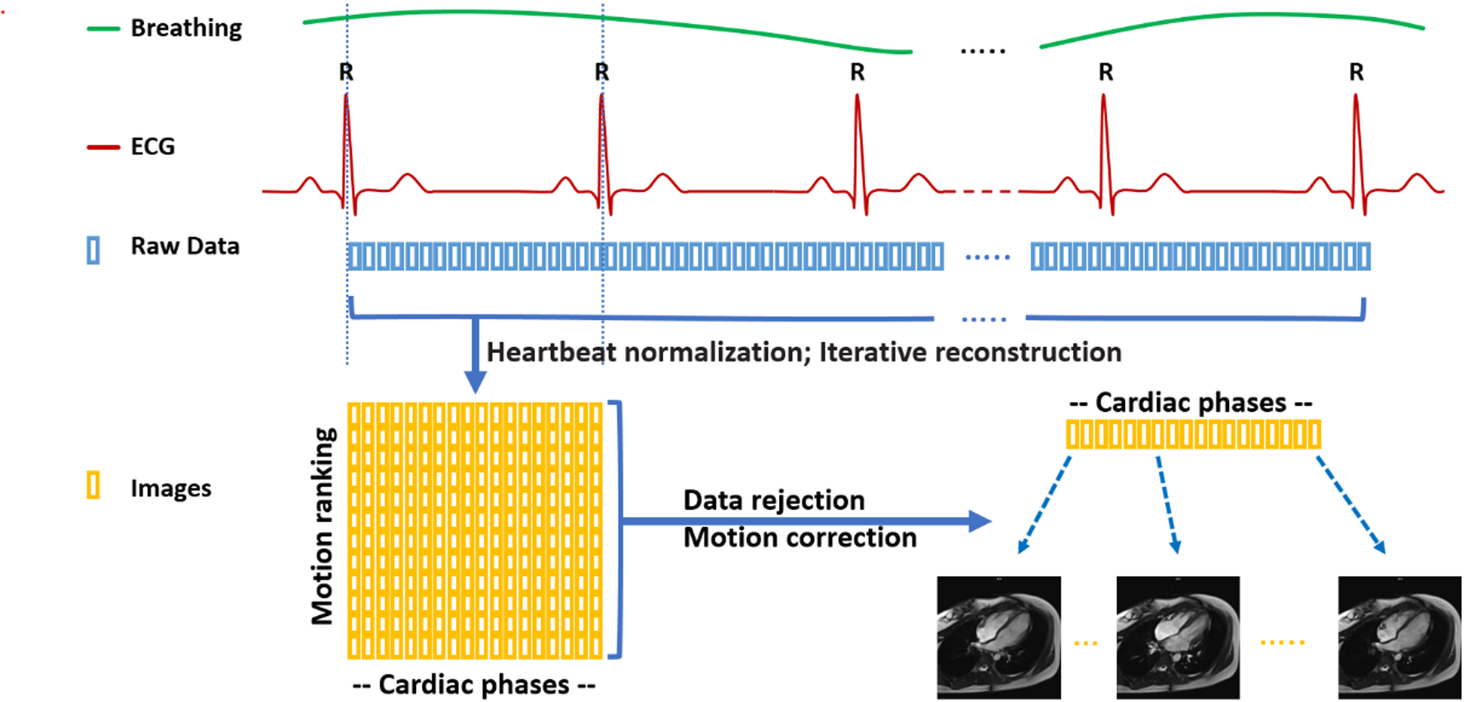 Full free-breathing motion-corrected cardiac cine and late gadolinium enhancement MRI: feasibility and validation in clinical practice