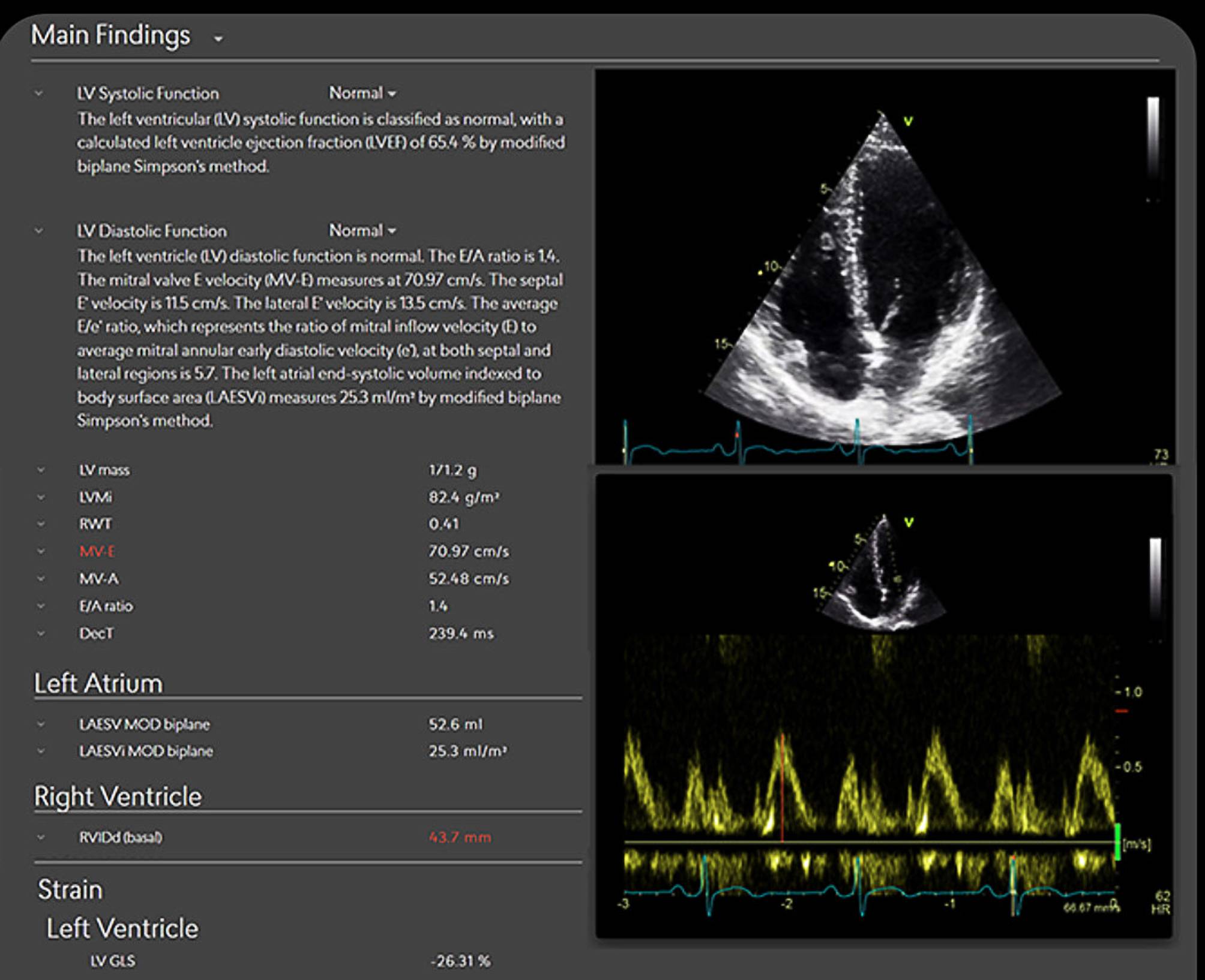 Transforming echocardiography with artificial intelligence